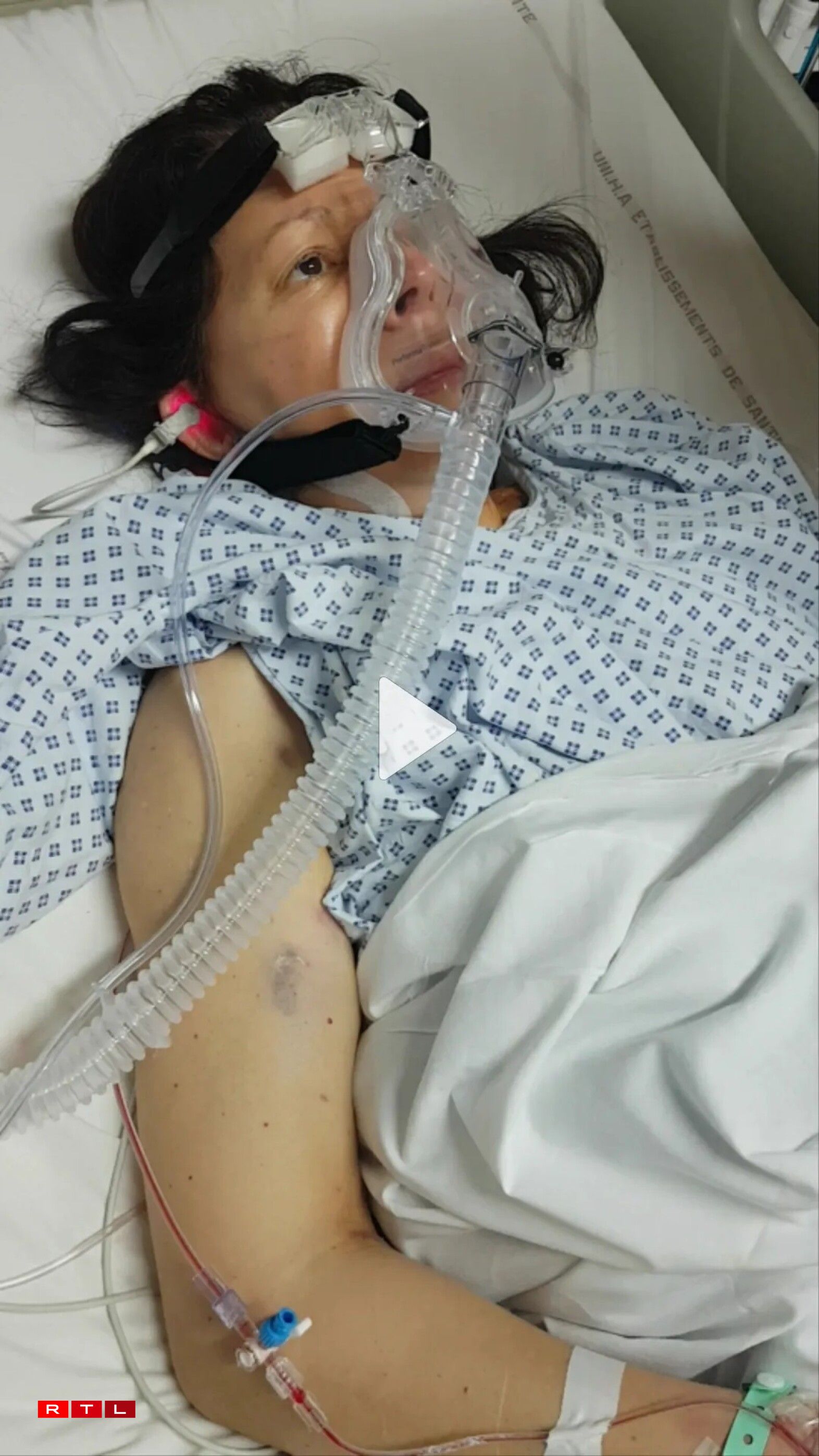 Der Véronique Scheins hiert Been konnt gerett ginn - ma de Präis si konstant Péng.