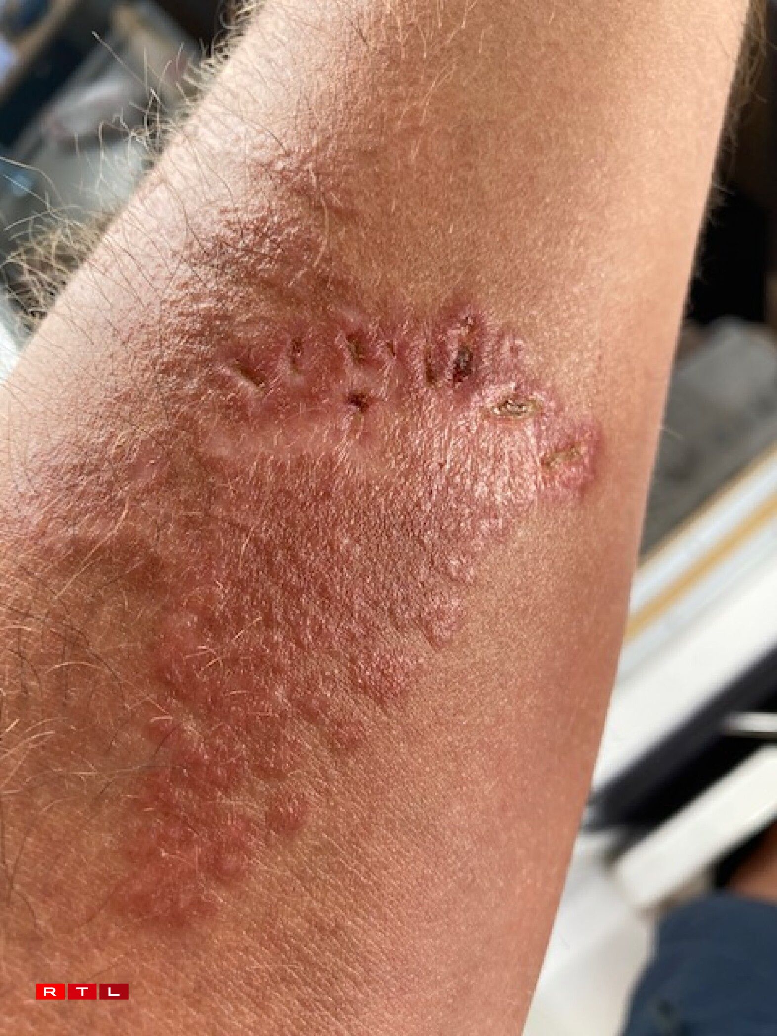 De Roland Miny ass virun engem Mount a Korsika vun engem Jelliskapp gepickt ginn.