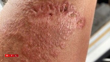 De Roland Miny ass virun engem Mount a Korsika vun engem Jelliskapp gepickt ginn.