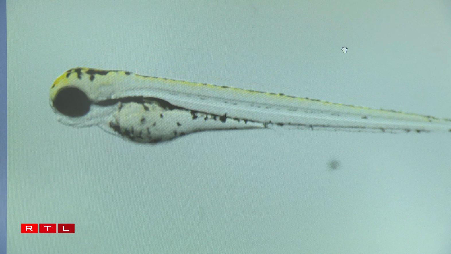 En Zebra-Fësch no e puer Deeg an hirer Entwécklung. Ënnert dem Mikroskop kann een ënnert anerem d'Häerz schloe gesinn.